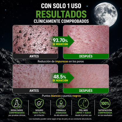 MASCARILLA FACIAL DETOX LIMPIADORA DE POROS, REMOVEDORA DE PUNTOS NEGROS, CONTROL DE GRASA Y ELIMINA IMPUREZAS