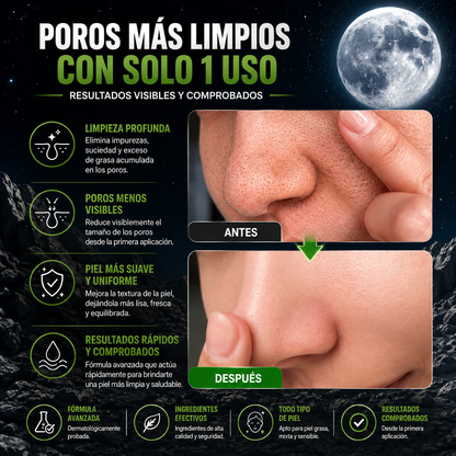 MASCARILLA FACIAL DETOX LIMPIADORA DE POROS, REMOVEDORA DE PUNTOS NEGROS, CONTROL DE GRASA Y ELIMINA IMPUREZAS