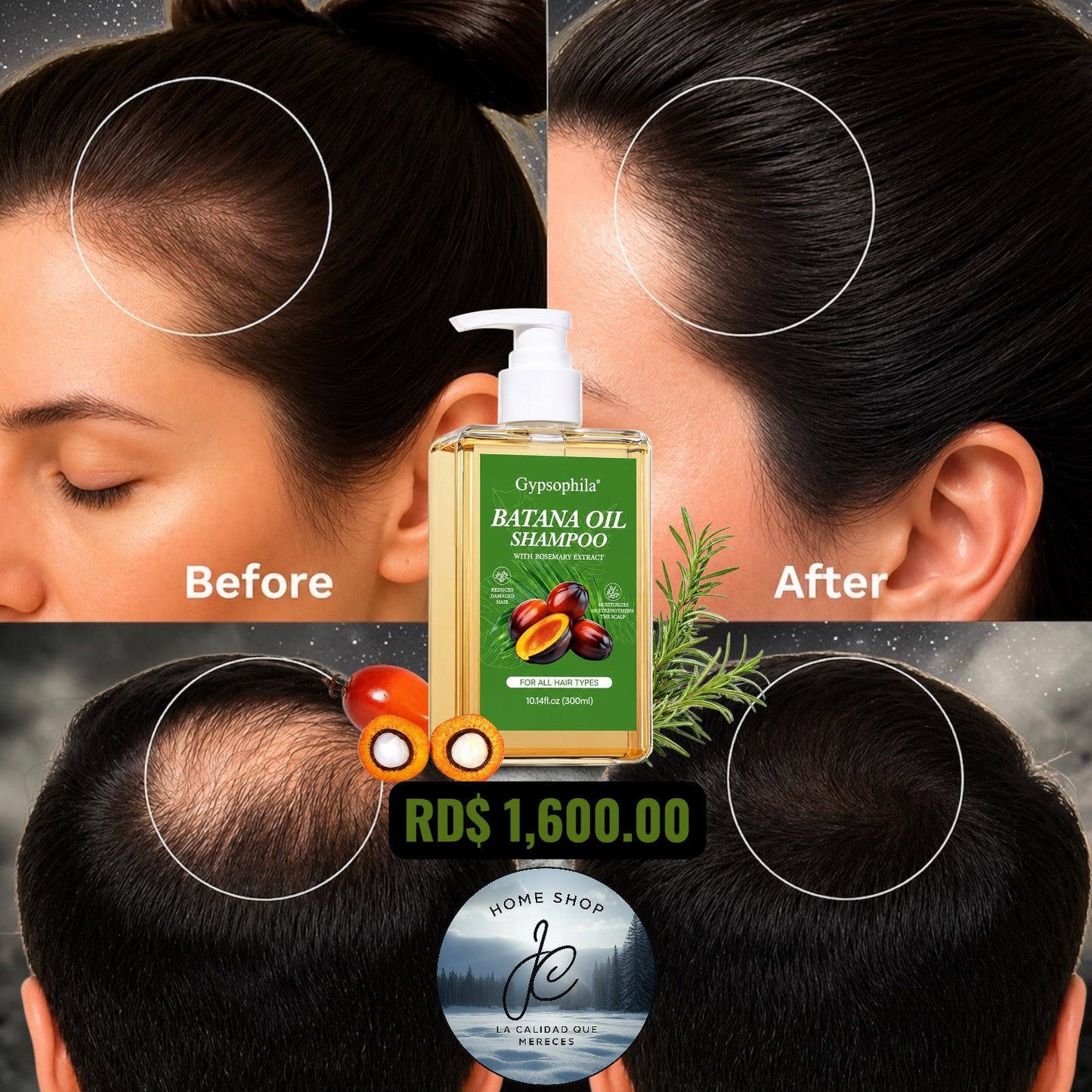 SHAMPOO DE ACEITE BATANA 10.14 FL OZ