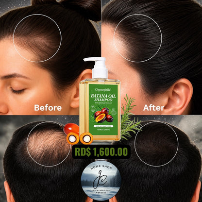 SHAMPOO DE ACEITE BATANA 10.14 FL OZ