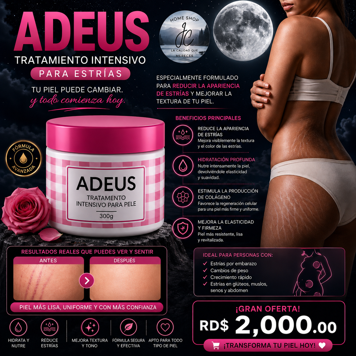 ADEUS ORIGINAL 300G TRATAMIENTO INTENSIVO PARA ESTRIAS